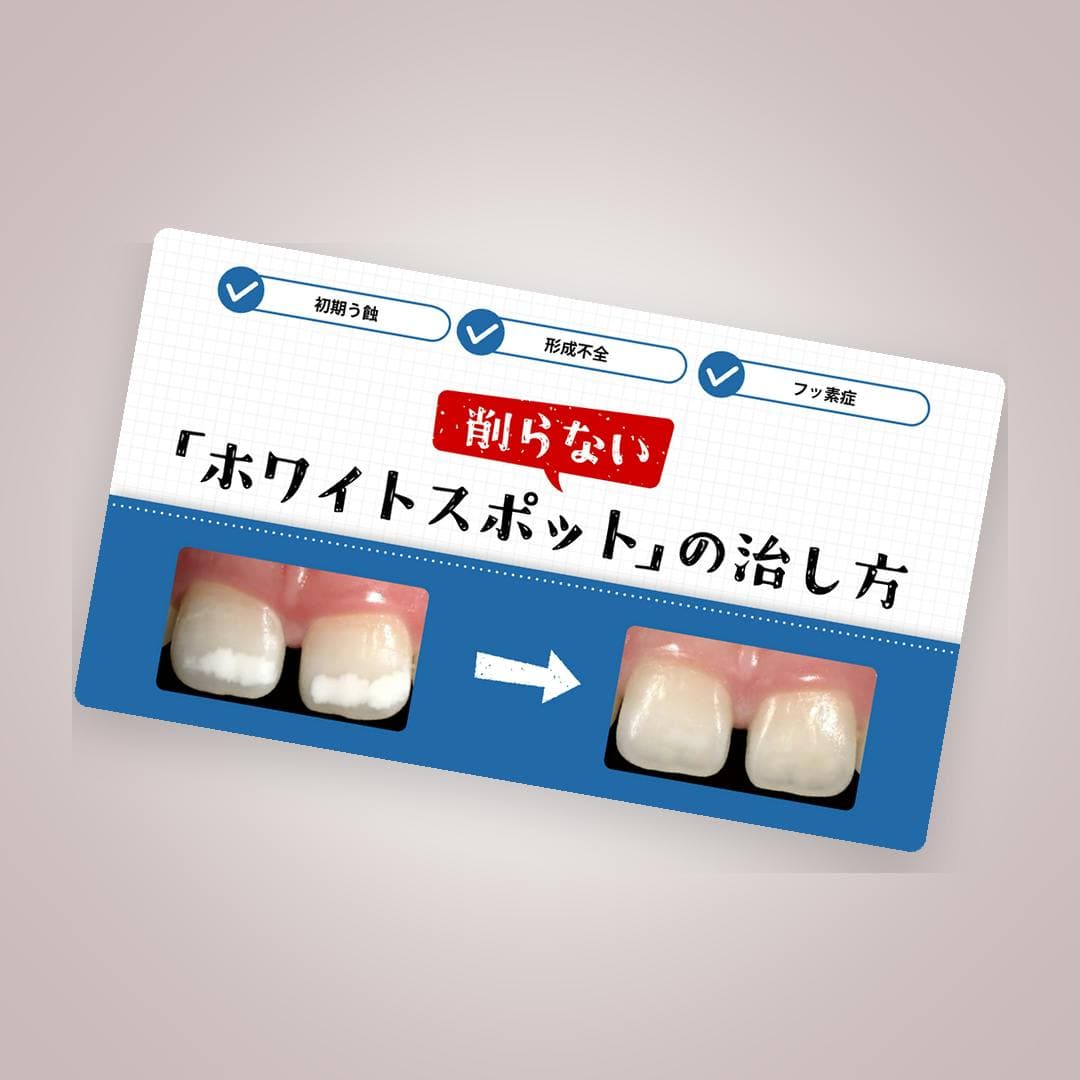 ホワイトスポット診査診断フローチャート