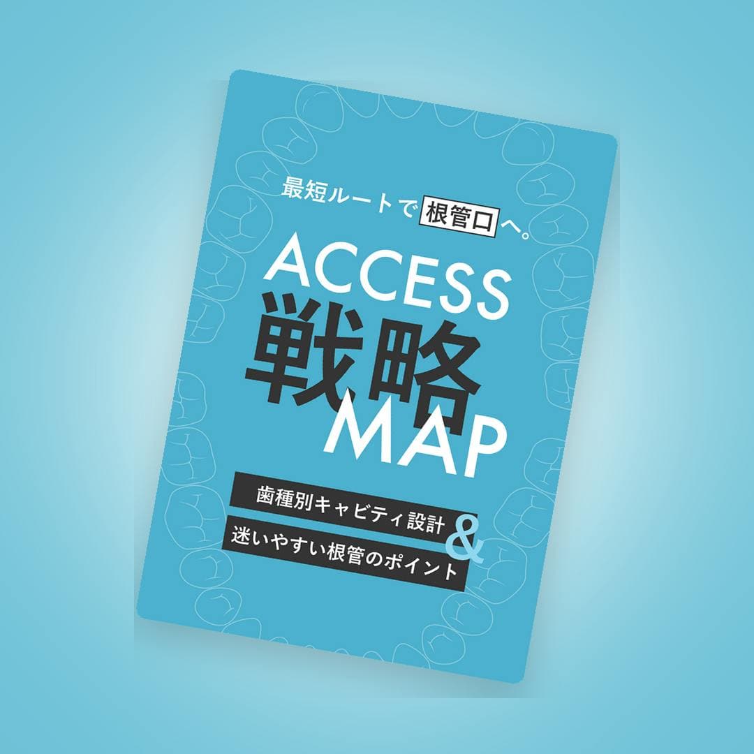 最短ルートで根管口へ！アクセスキャビティ戦略MAP