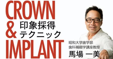 クラウン＆インプラント印象採得テクニック