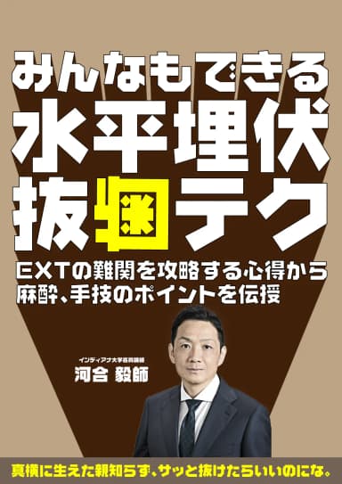 ランキング20位のみんなもできる水平埋伏抜歯テク