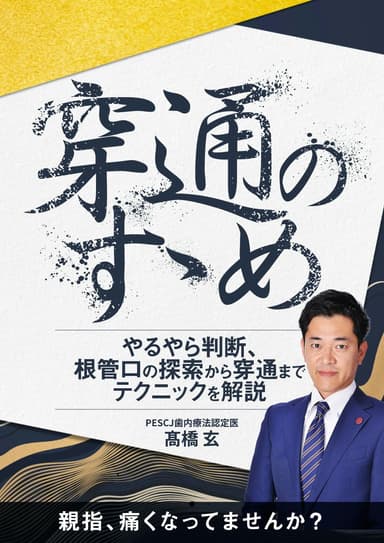 ランキング12位の穿通のすゝめ