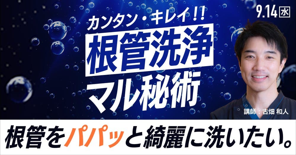 カンタン・キレイ！根管洗浄マル秘術 - 根管、パパッとキレイに洗いたい。