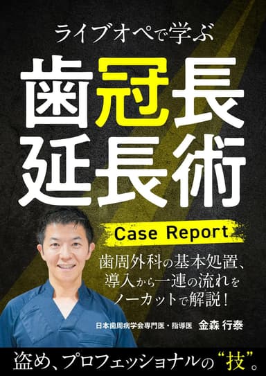 ランキング20位のライブオペで学ぶ「歯冠長延長術」＜Case Report＞
