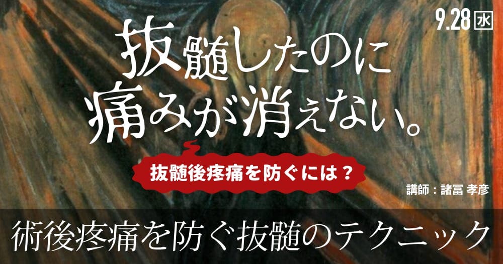 抜髄したのに、痛みが消えない。 - エンド術後疼痛の原因・診断・対応法