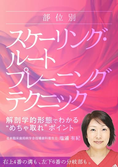 ランキング15位の部位別「スケーリング・ルートプレーニング」テクニック