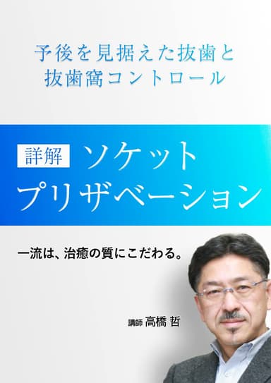 ランキング18位の詳解「ソケットプリザベーション」