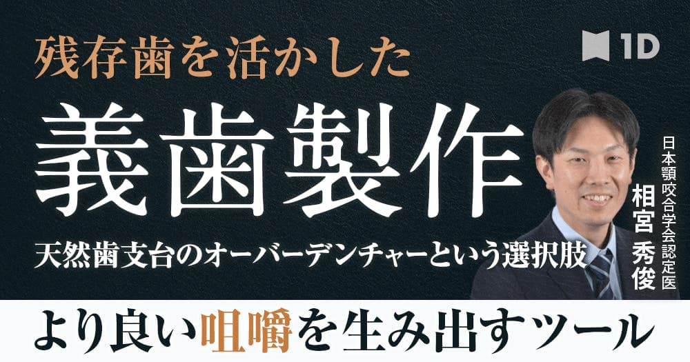 天然歯支台のオーバーデンチャー - 理想的な設計とアタッチメント選択