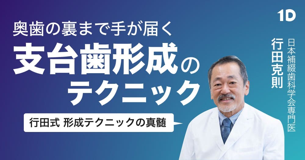 テーパー過剰を回避する、支台歯形成のテクニック - 行田式形成テクニックの真髄