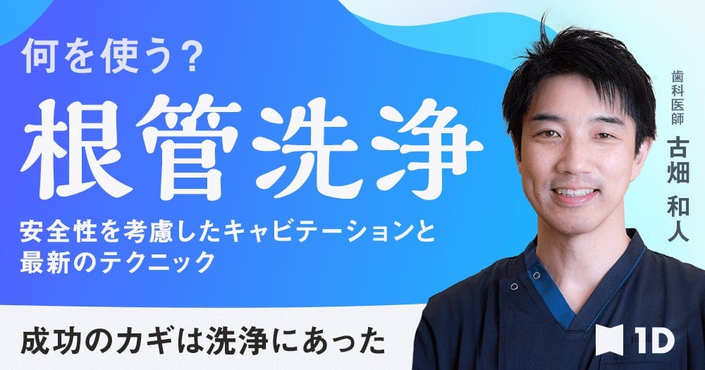何を使う？根管洗浄 - 安全性を考慮したキャビテーションと最新のテクニック