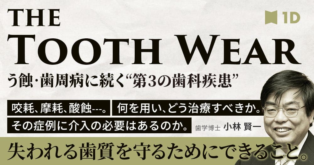 The Tooth Wear：失われる歯質を守るために - 失われる歯質を守るために