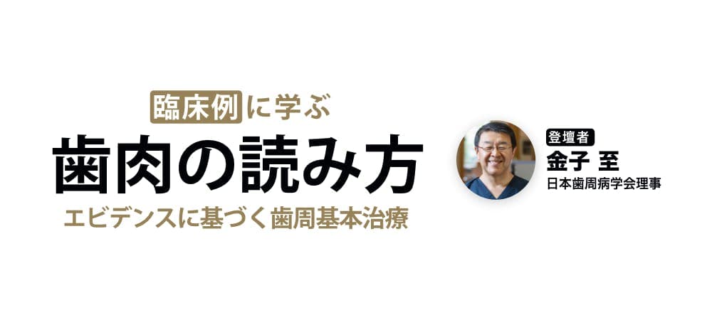 臨床例に学ぶ「歯肉の読み方」 - エビデンスに基づく歯周基本治療