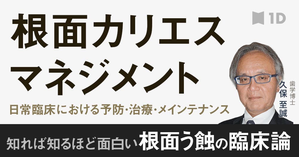 根面う蝕の最新マネジメント論 - 予防と治療、メインテナンス
