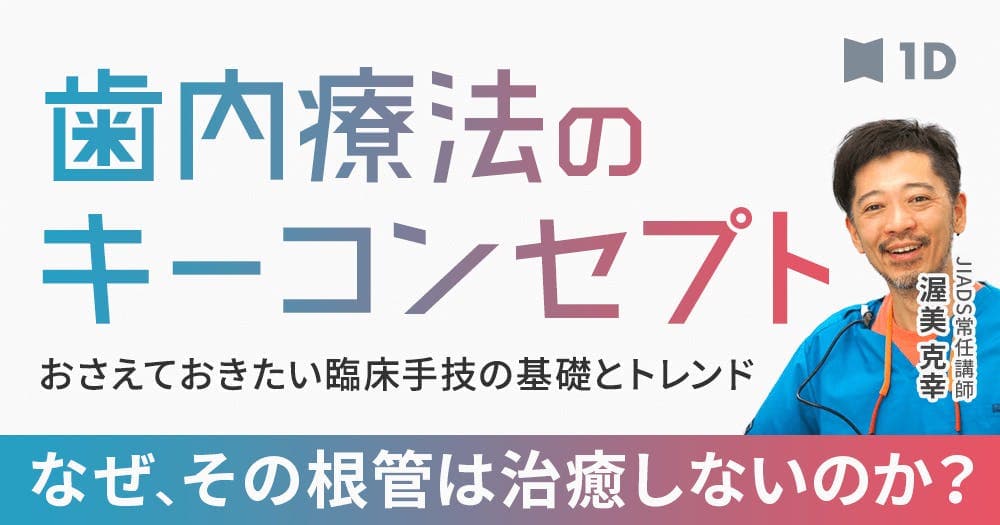 歯内療法のキーコンセプト - おさえておきたい臨床手技の基礎とトレンド