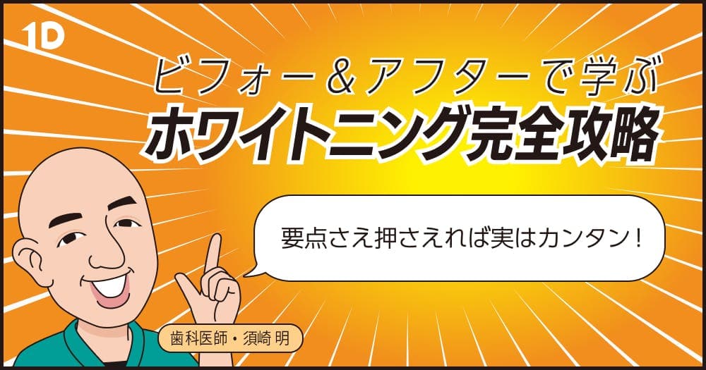 ビフォー&アフターで学ぶ、ホワイトニング完全攻略 - 白くなる秘訣がわかる90分