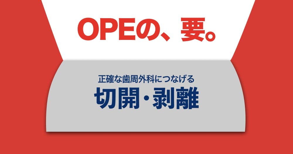 正確な歯周外科につなげる切開・剥離 - 予知性の高い歯周外科は、切開から始まる