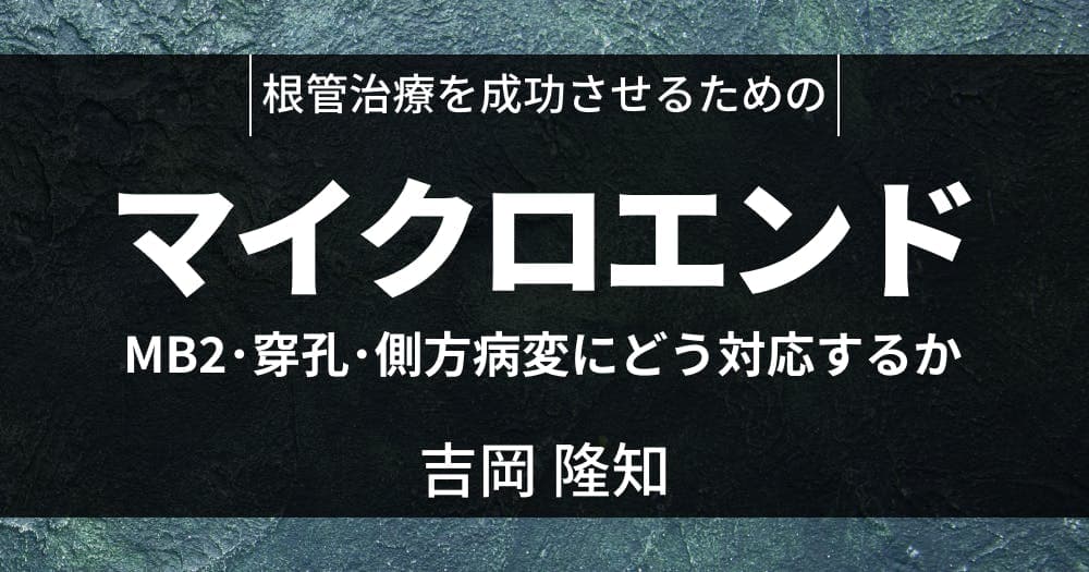マイクロエンドで、難症例を治す - スペシャリストに学ぶ「コツと理論」