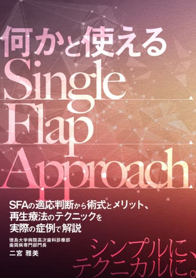 ランキング12位の何かと使えるSingle Flap Approach