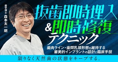 抜歯即時埋入＆即時修復テクニック