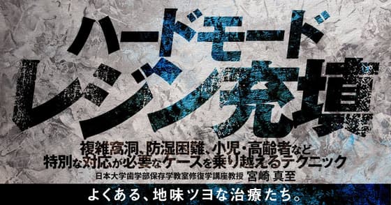 ハードモードレジン充填