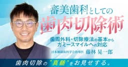 審美歯科としての「歯肉切除術（歯肉整形術）」