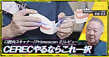 CERECやるならこれ一択。口腔内スキャナー「Primescan 2」レビュー