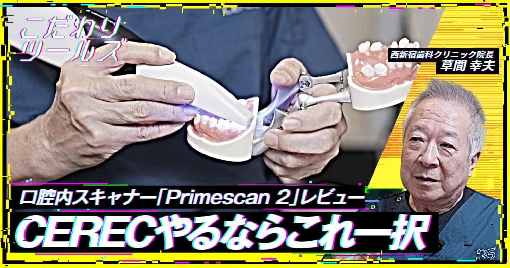 CERECやるならこれ一択。口腔内スキャナー「Primescan 2」レビュー