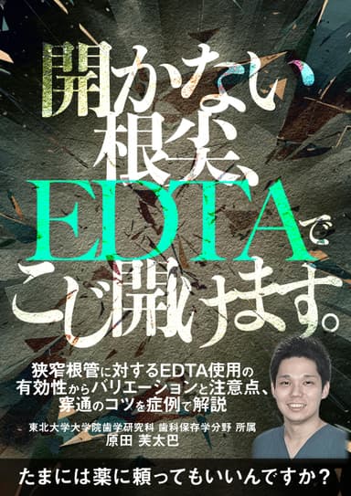 ランキング15位の開かない根尖、EDTAでこじ開けます。