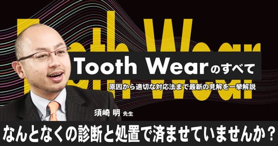 Tooth Wearのすべて