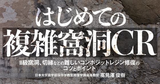 はじめての「複雑窩洞CR」