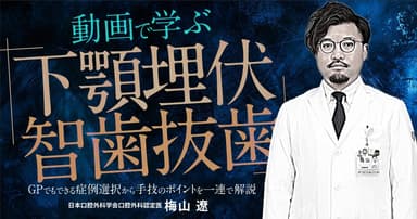 動画で学ぶ「下顎埋伏智歯抜歯」