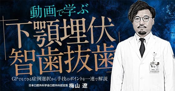 動画で学ぶ「下顎埋伏智歯抜歯」