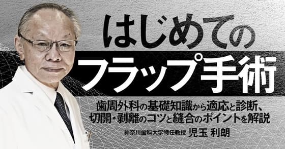 はじめての「フラップ手術」