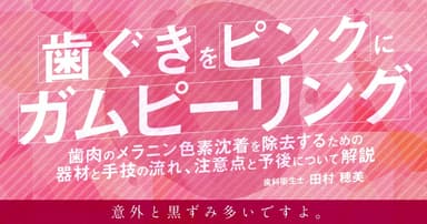 歯ぐきをピンクにガムピーリング