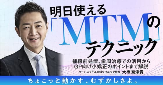 明日使える「MTM」のテクニック