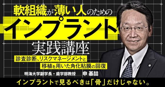 軟組織が薄い人のためのインプラント実践講座