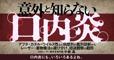 意外と知らない「口内炎」 