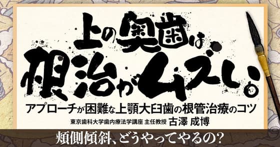  上の奥歯は、根治がムズい。