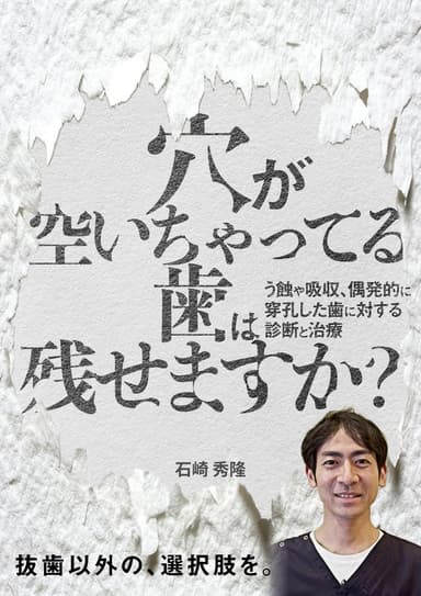 ランキング15位の穴が空いちゃってる歯は残せますか？