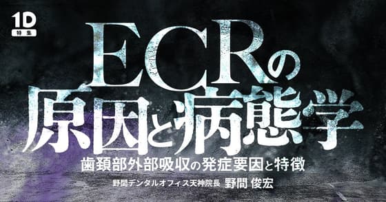 ECRの原因と病態学