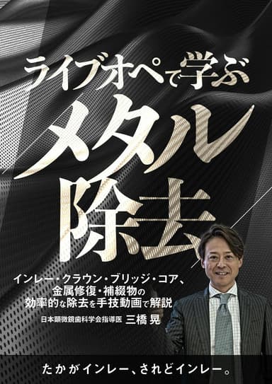 ランキング1位のライブオペで学ぶ「メタル除去」