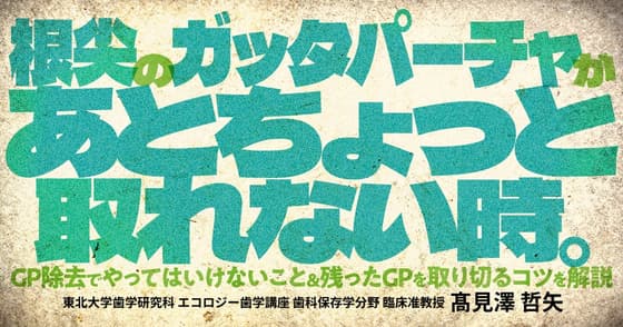 根尖のガッタパーチャがあとちょっと取れない時。