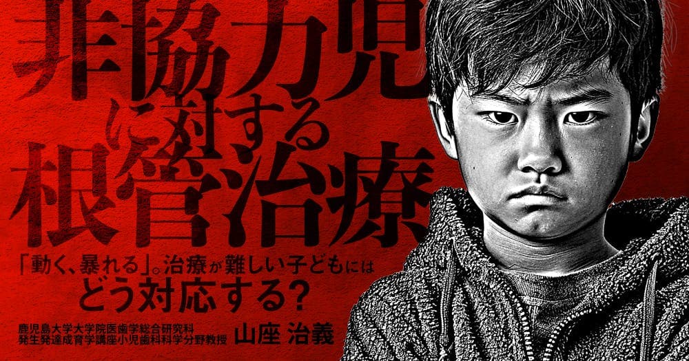 非協力児に対する根管治療