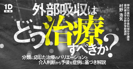 外部吸収はどう治療すべきか？