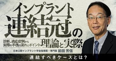 インプラント連結冠の理論と実際