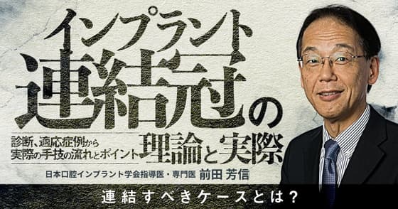インプラント連結冠の理論と実際