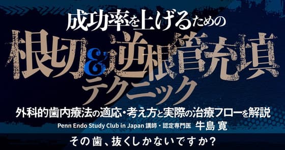成功率を上げるための根切&逆根管充填テクニック