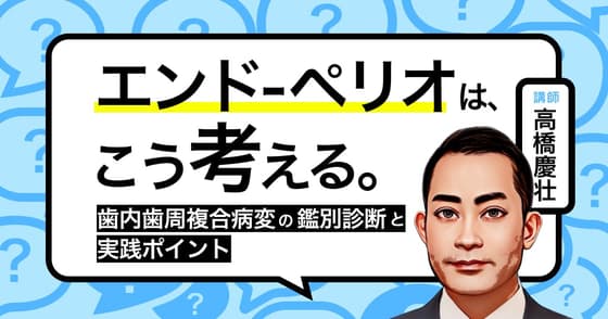 「エンド-ペリオ」は、こう考える。