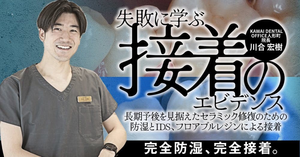 失敗に学ぶ「接着のエビデンス」 - 長期予後を見据えたセラミック修復のための防湿とIDS、フロアブルレジンによる接着