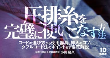 圧排糸を完璧に使いこなす方法
