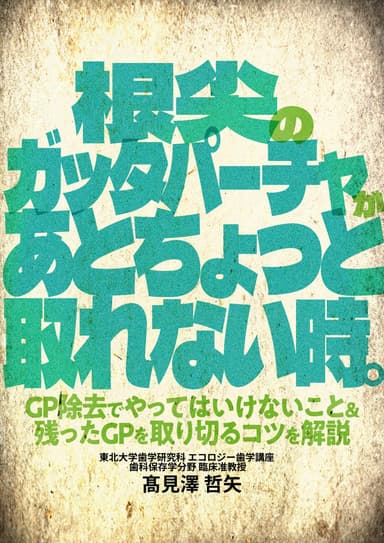 ランキング17位の根尖のガッタパーチャがあとちょっと取れない時。